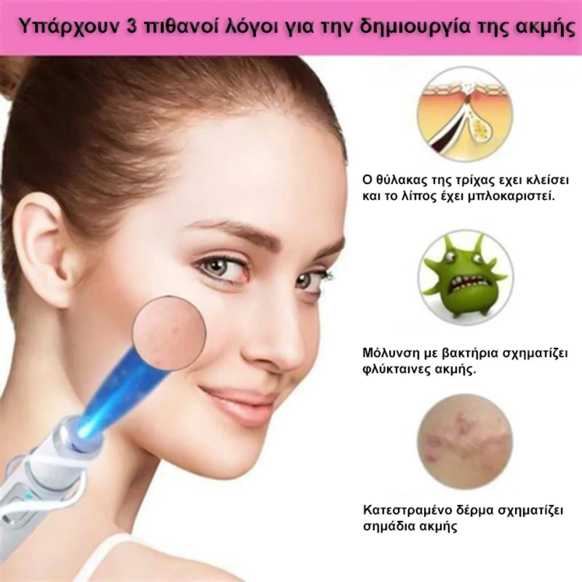 Στυλό Λέιζερ κατά της Ακμής και Θεραπεία του Δέρματος Blue Light Acne Pen KD-7910