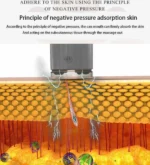 Παραδοσιακή Θεραπευτική Συσκευή με Βεντούζες 24 Ανταλλακτικών Κεφαλών