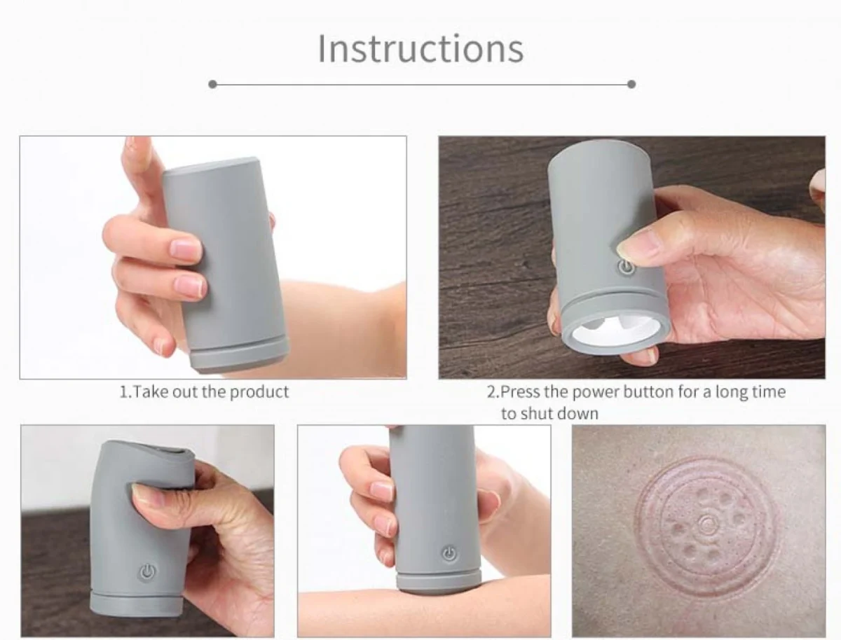 Παραδοσιακή Θεραπευτική Συσκευή με Βεντούζες 24 Ανταλλακτικών Κεφαλών