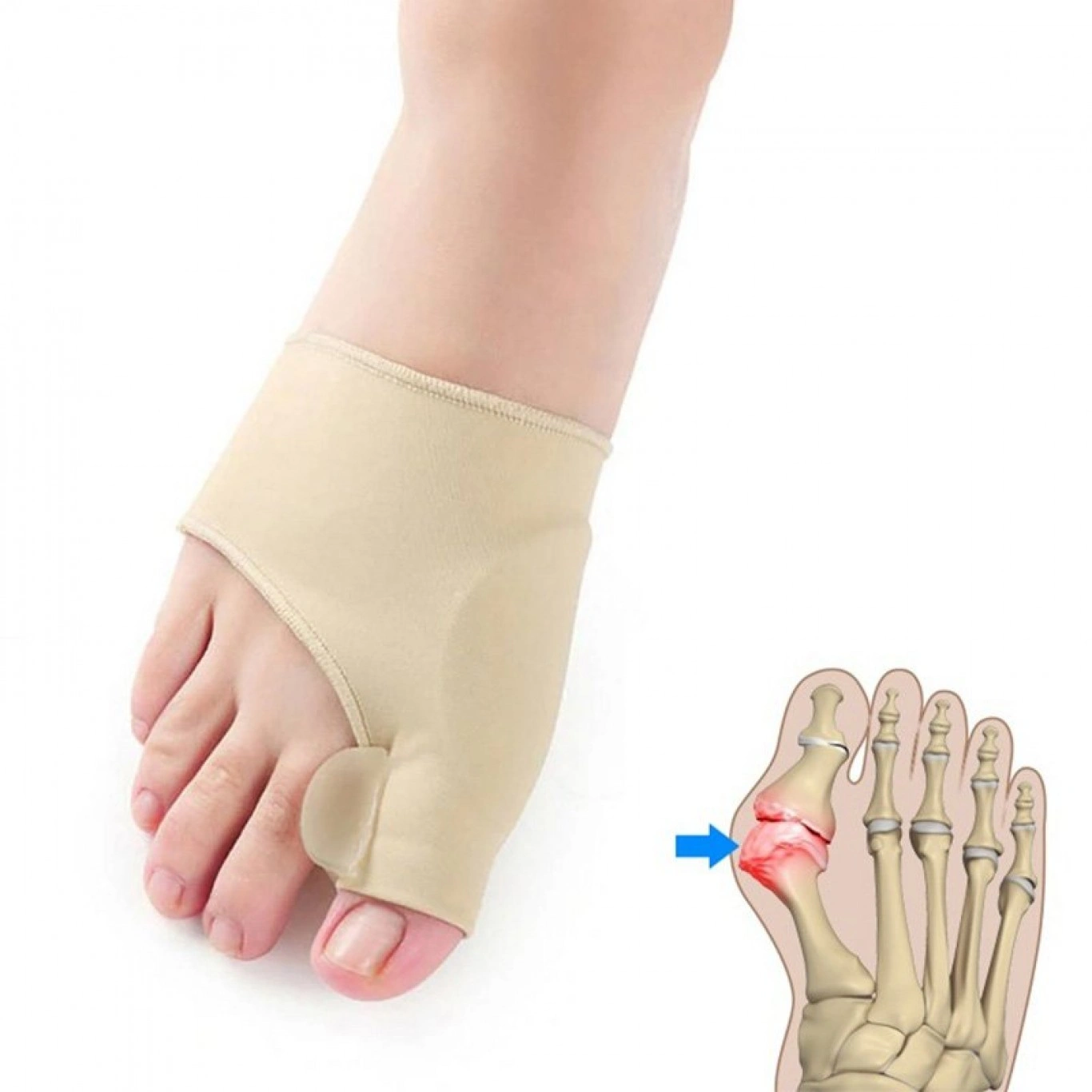 2 x Ορθοπεδικός Διορθωτής Δακτύλων Ποδιού - 1 Ζευγάρι για Δεξί & Αριστερό - Toe Supporter 2 x Ορθοπεδικός Διορθωτής Δακτύλων Ποδιού - 1 Ζευγάρι για Δεξί & Αριστερό - Toe Supporter