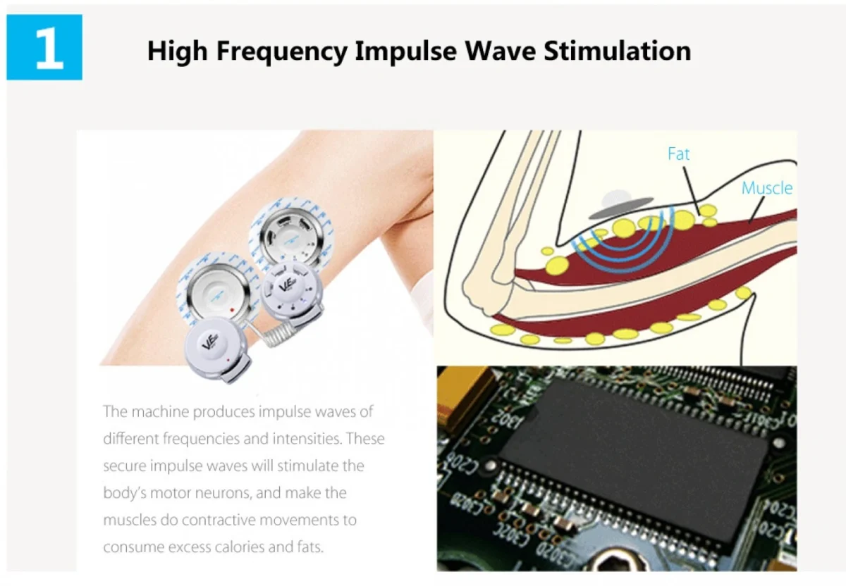 Επαναφορτιζόμενη Συσκευή Αδυνατίσματος & Εκγύμνασης Μυών - Μηχάνημα Ηλεκτρομυικής Διέγερσης - Radio Sculpting Slimming Instrument