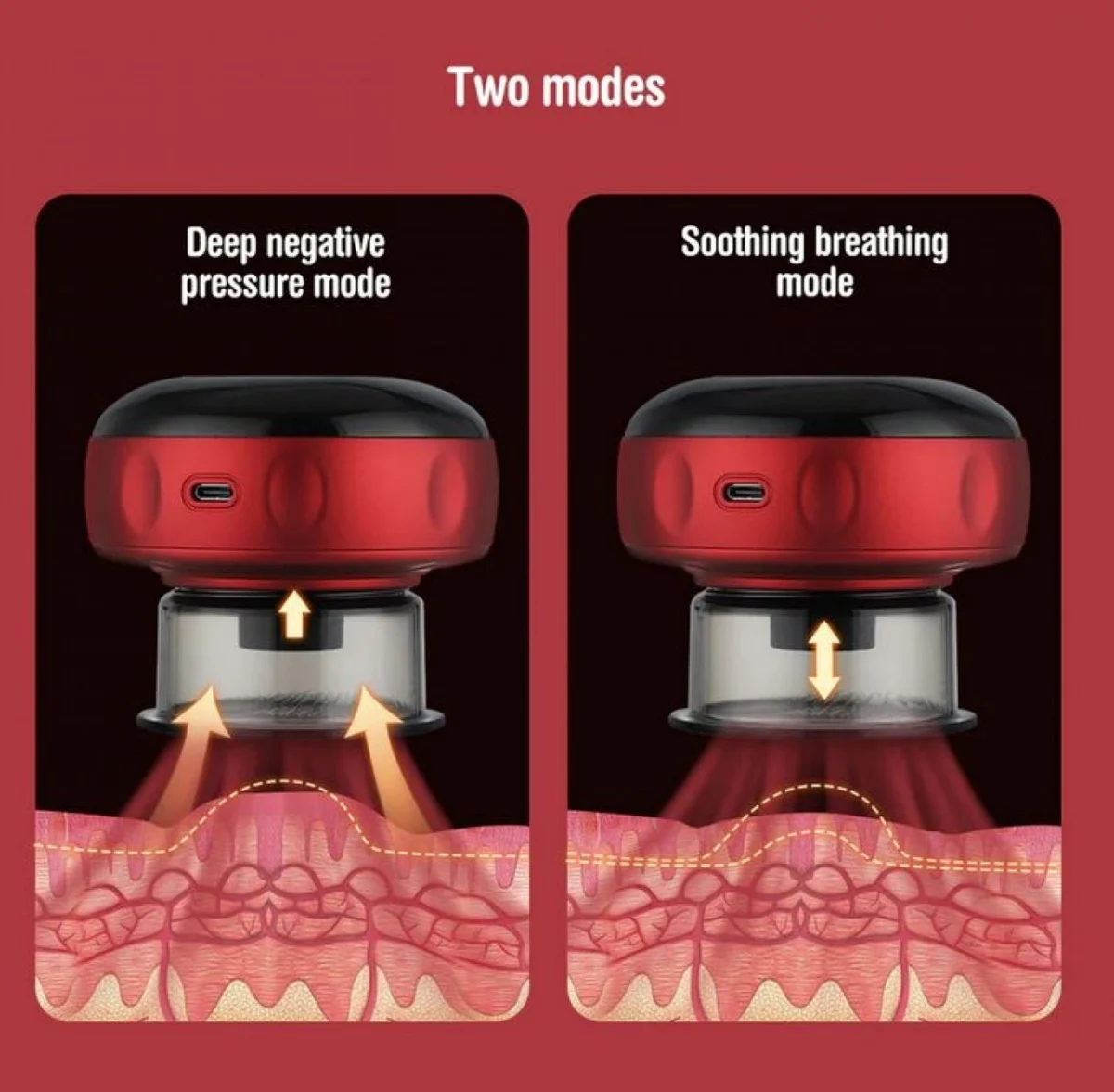 Επαναφορτιζόμενη Ηλεκτρική Βεντούζα - Inteligent Breathing Cupping Massage Instrument
