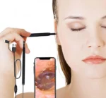 Ενδοσκοπική Πολυλειτουργική Κάμερα μικροσκόπιο για Καθαρισμό Αυτιών