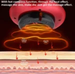 Επαναφορτιζόμενη Θεραπευτική Συσκευή - Βεντούζα για Μασάζ και Λιποδιάλυση - Intelligent Scraping Cupping