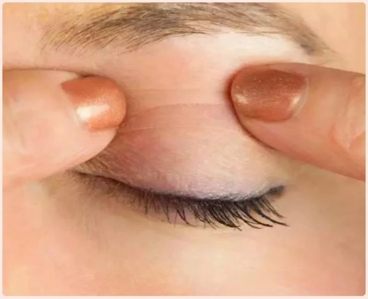 Αυτοκόλλητο Ανόρθωσης Βλεφάρου Eyelid Lift Strips 810 Τεμάχια