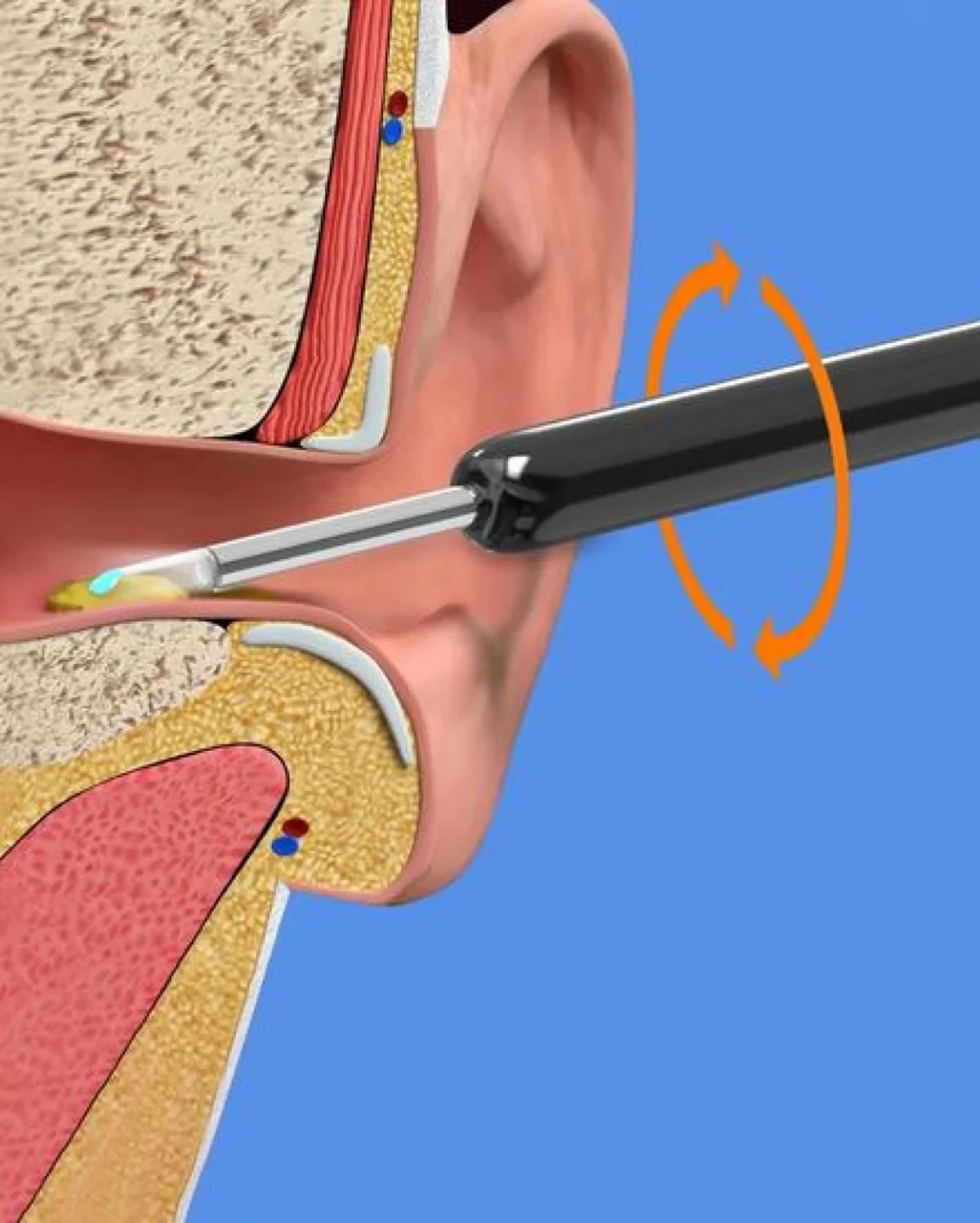 Επαναφορτιζόμενο Ωτοσκόπιο WiFi με κάμερα και Εφαρμογή για Smartphone