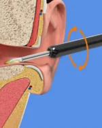 Επαναφορτιζόμενο Ωτοσκόπιο WiFi με κάμερα και Εφαρμογή για Smartphone