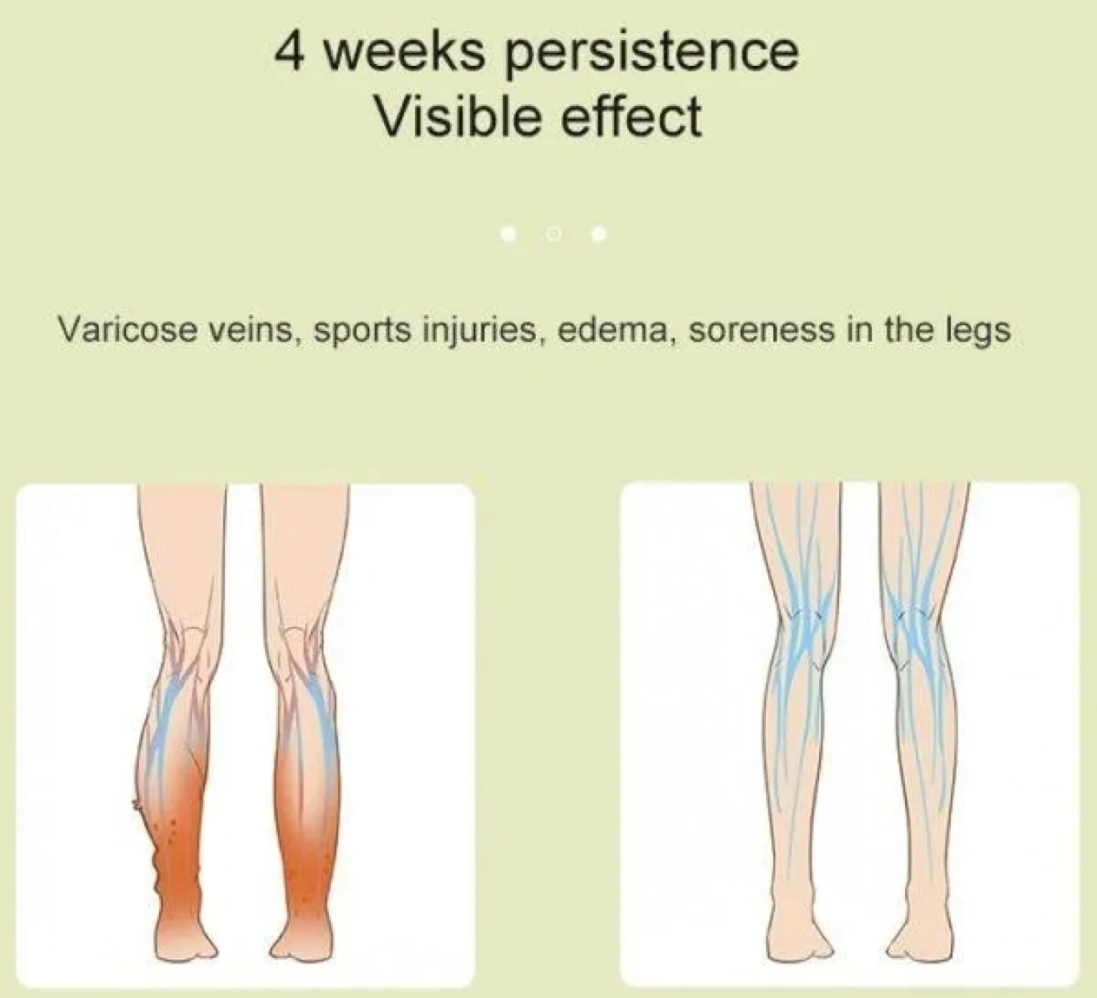 MD-060 1 Τεμάχιο Φορητή Θερμαινόμενη Συσκευή Πρεσοθεραπείας & Μασάζ για Γάμπες - Portable Calf Massager