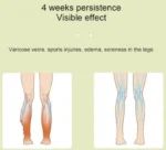 MD-060 1 Τεμάχιο Φορητή Θερμαινόμενη Συσκευή Πρεσοθεραπείας & Μασάζ για Γάμπες - Portable Calf Massager