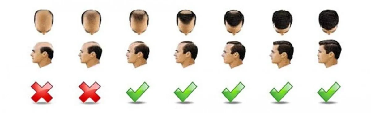 Sevich Hair Building Fibers - Μικρο-ίνες Κερατίνης για Πλούσια Μαλλιά 25γρ - Sevich Hair Building Fibers - Dark Brown